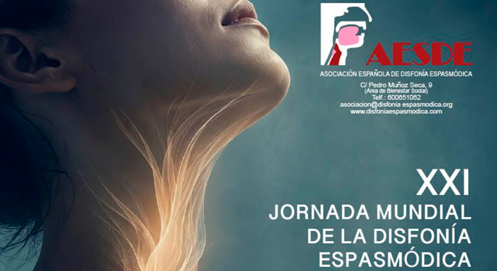 La Asociación Española de Disfonía Espasmódica, AESDE, asiste en Madrid a la XXI Jornada Mundial de la Disfonía Espasmódica